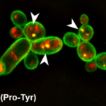 Identifican la molécula de una bacteria capaz de eliminar hongos y nemátodos en varios cultivos